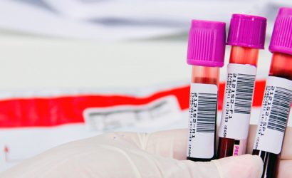 O que é um Contador de Células Sanguíneas- Como Funciona?!