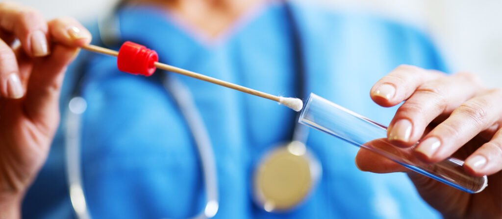 O que é um Swab - Função e Procedimentos na Coprocultura