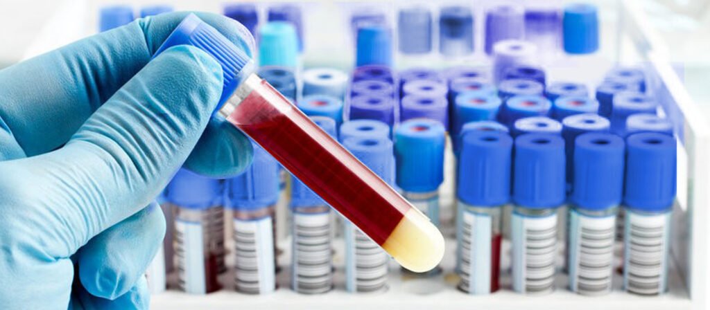 O que é o Tubo de Coleta de sangue a Vácuo Vantagens