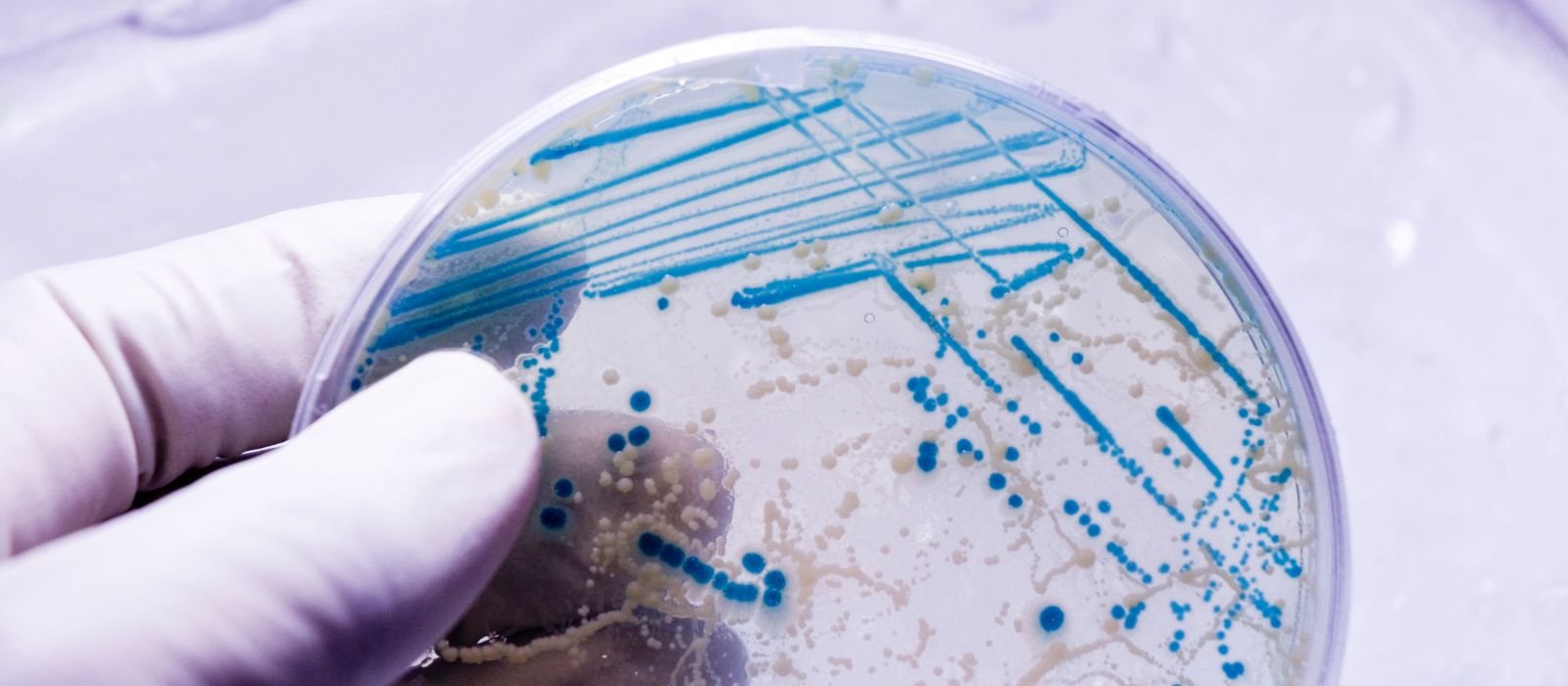 O que é o Caldo Nutriente em Microbiologia- Leia mais