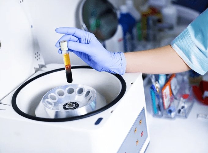 Saiba mais sobre a Centrífuga Sorológica - Guia do Comprador