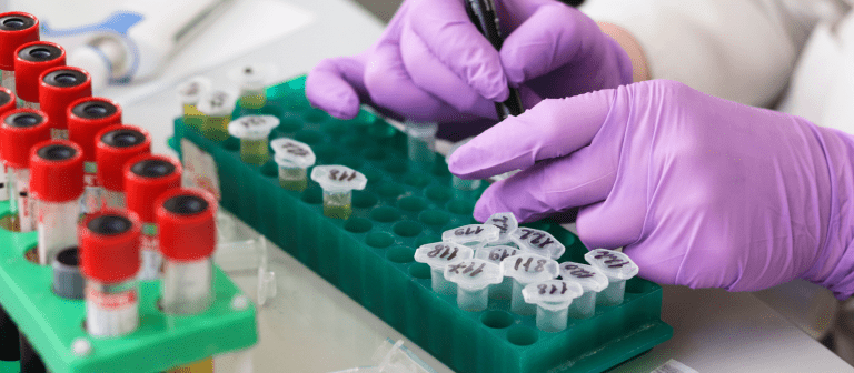 contaminação cruzada em material de laboratório