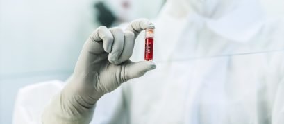 Impacto da Temperatura na Estabilidade de Amostras