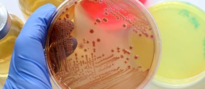 Jarra de anaerobiose