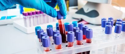 O que são Tubos de coleta de sangue Entenda suas cores