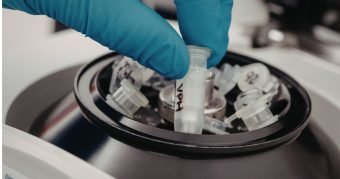 Para que serve uma centrífuga de laboratório Aplicações