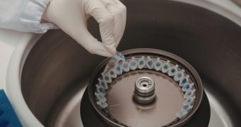 Quanto custa uma centrífuga de laboratório e o que avaliar
