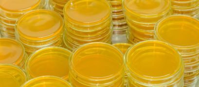 Vamos entender a Importância do Ágar Citrato Simmons