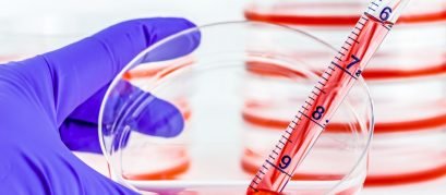 ágar baird parker (1)