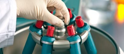 centrifugablogsplabor