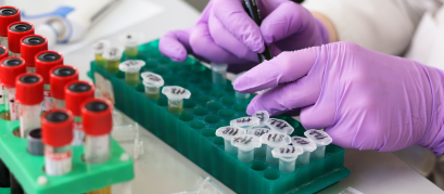 contaminação cruzada em material de laboratório