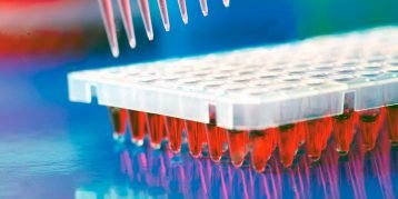 PCR