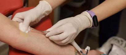 scalp para a coleta de sangue